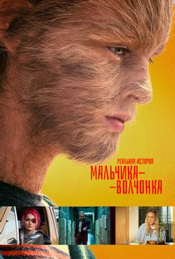 Реальная история мальчика-волчонка Реальная история мальчика-волчонка