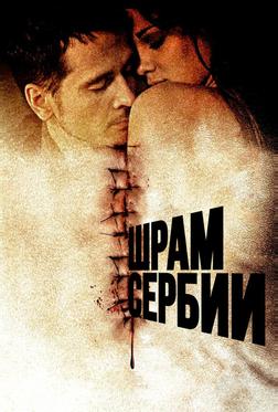 Шрам Сербии